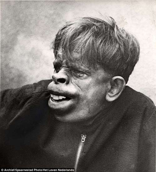 Xôn[-]xao[-]với[-]bức[-]ảnh[-]"người[-]khỉ",[-]Phi[-]thường[-]-[-]kỳ[-]quặc,[-]nguoi[-]khi,[-]xon[-]xao,[-]chuyen[-]la,[-]chuyen[-]la[-]the[-]gioi,[-]phi[-]thuong[-]kỳ[-]quac